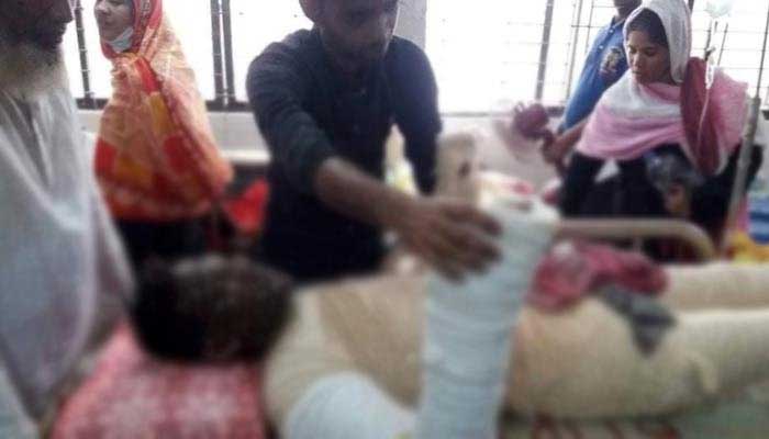 মহাখালীতে গ্যাস লাইন লিকেজ, আগুনে দগ্ধ ৩