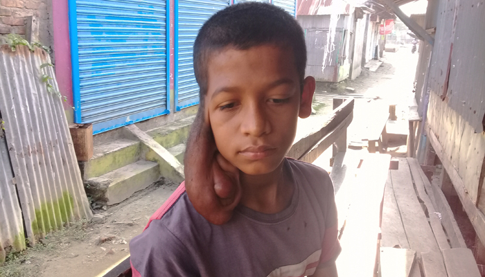 রোগটা অজানা, হচ্ছে না চিকিৎসা