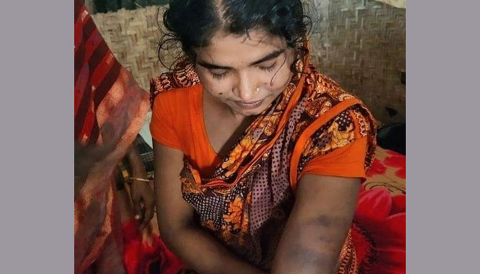 ধর্মান্তরিত স্ত্রীকে যৌতুকের দাবিতে পিটিয়েছেন স্বামী