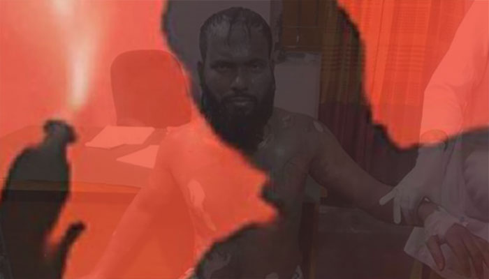 তিন বিয়ে করায় স্বামীকে অ্যাসিড নিক্ষেপ!