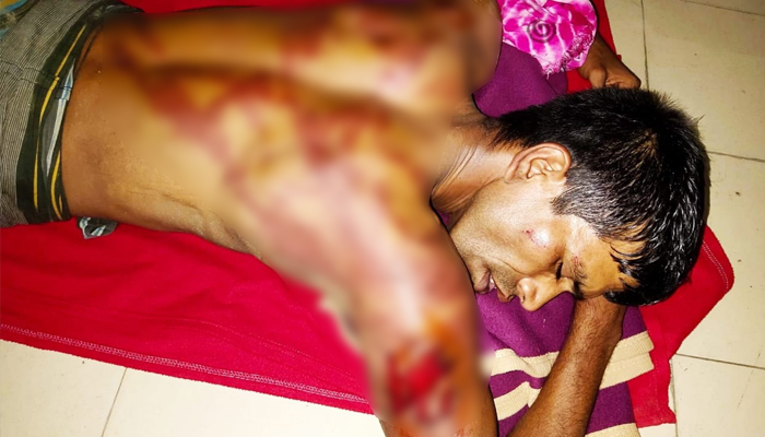 চুরির অভিযোগে রাজমিস্ত্রীকে পিটিয়ে জখম, আটক -২