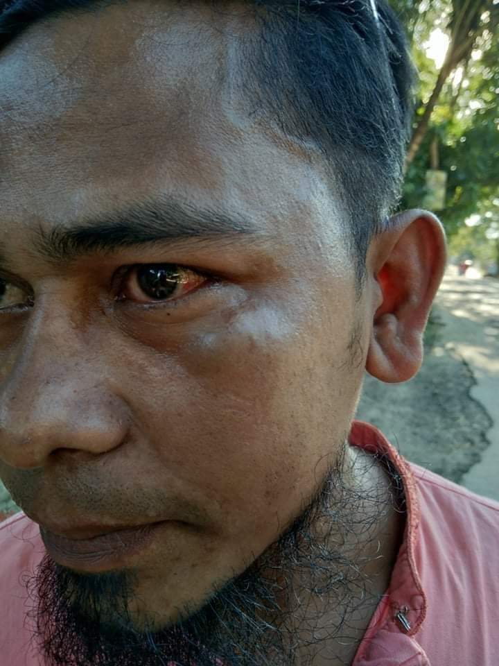 আহম্মেদ শফীর ওপর হামলা