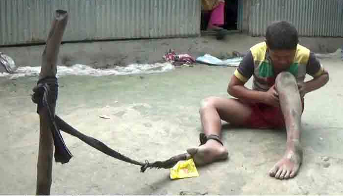 সাদিকের পা বাঁধা ১০ বছর ধরে