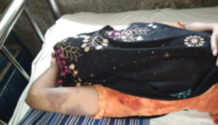 যৌতুক না পেয়ে মধ্যযুগীয় কায়দায় গৃহবধূ নির্যাতন