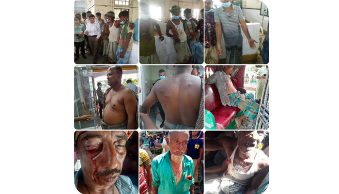 সাতকানিয়ায় ড্রেজিং নিয়ে বিরোধ, প্রতিপক্ষের গুলি
