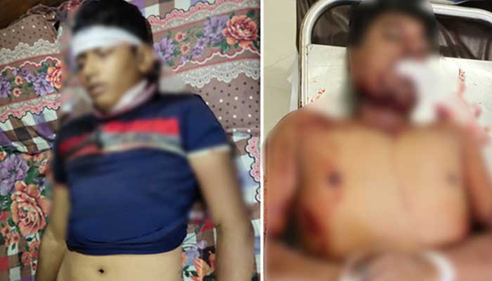 সাতকানিয়ায় পালিয়ে বাঁচলেন ইউপি চেয়ারম্যান, গুলিবিদ্ধসহ আহত ৩