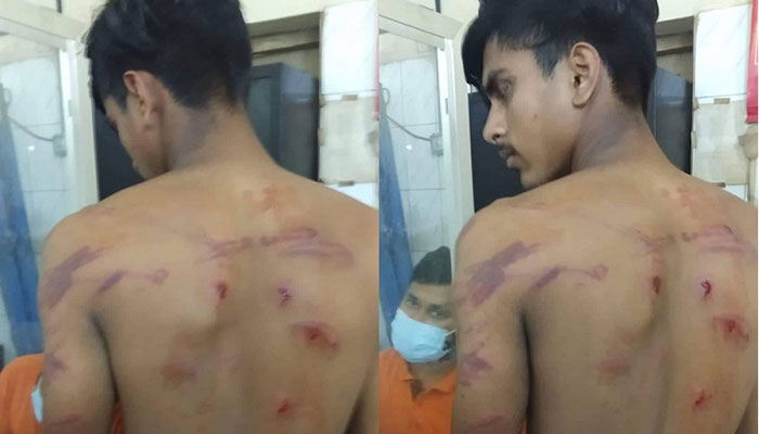 ক্লাসে হাসাহাসি: শিক্ষার্থীকে পিটিয়ে হাসপাতালে পাঠালেন শিক্ষক