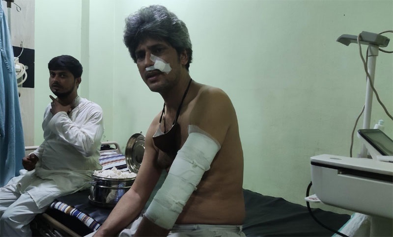 চমেকে দগ্ধদের দেখতে গিয়ে হামলায় আহত জোনায়েদ সাকি