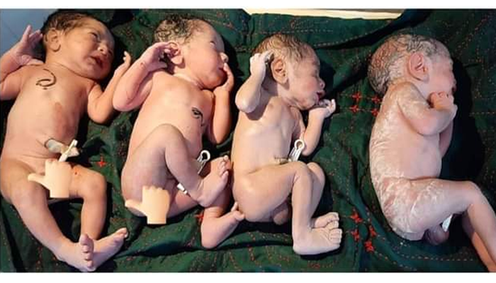 রামগড়ে একসঙ্গে ৪ সন্তানের জন্ম