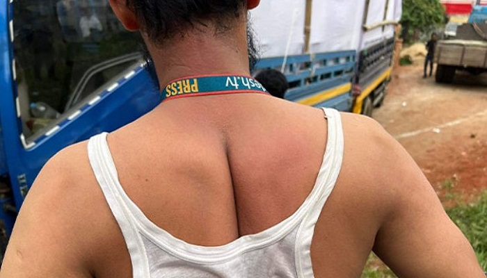 বিএনপির সমাবেশে সাংবাদিকদের ওপর হামলা