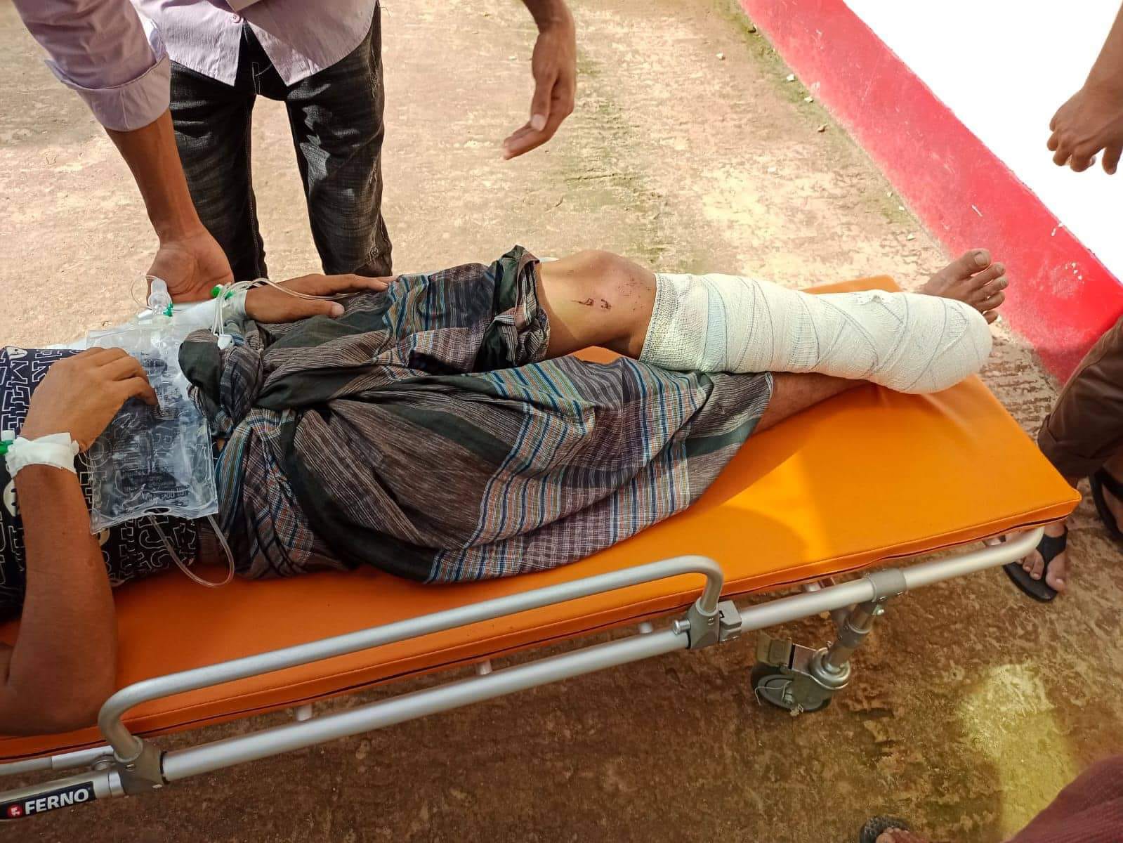 তুমব্রু সীমান্তে মাইন বিস্ফোরণ, বাংলাদেশি যুবকের পা বিচ্ছিন্ন