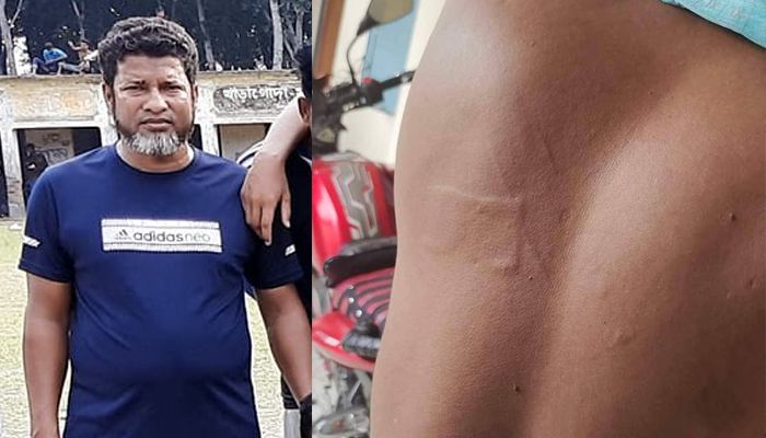 চুয়াডাঙ্গায় ক্রীড়া শিক্ষককে পেটালেন প্রধান শিক্ষক