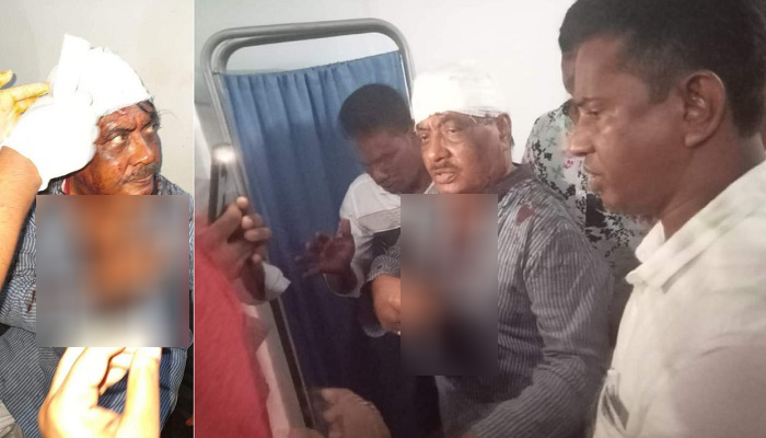 কুমিল্লায় বিএনপি নেতা বুলুর ওপর হামলা