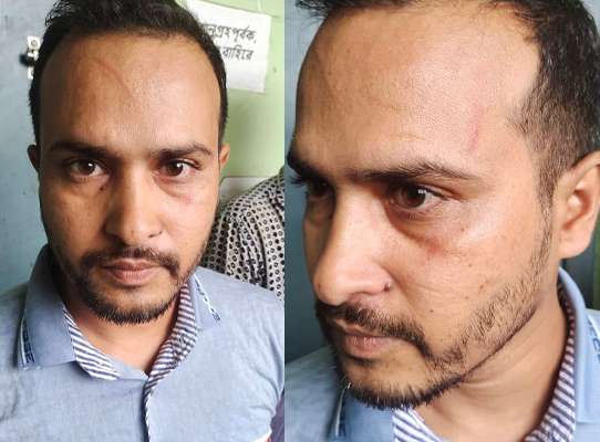 চুয়াডাঙ্গায় ক্রীড়া শিক্ষককে পেটালেন প্রধান শিক্ষক