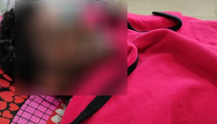গাইবান্ধায় দুই ভাই অ্যাসিডে দগ্ধ