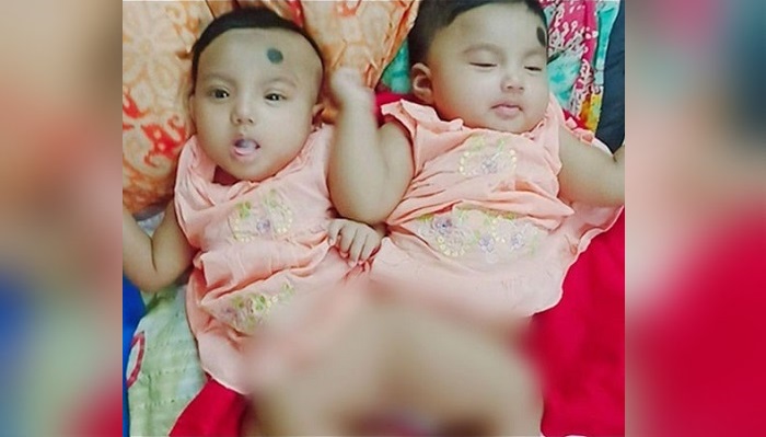 নুহা-নুবার চিকিৎসার দায়িত্ব নিয়েছেন প্রধানমন্ত্রী