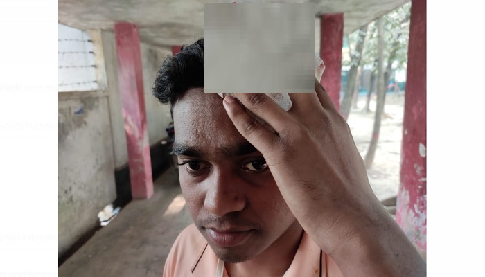 হল কর্মচারীর মাথা ফাটিয়ে দিলেন ঢাবি শিক্ষার্থী