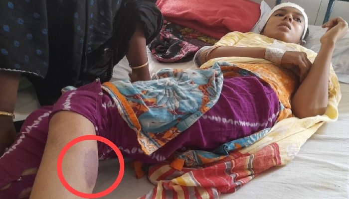 মান্দায় গৃহবধূকে মধ্যযুগীয় কায়দায় নির্যাতন