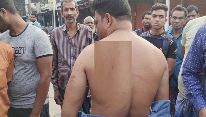 বাঘায় ডিশ লাইনের সংযোগকে কেন্দ্র করে হামলা, আহত ৫