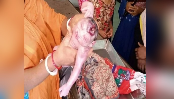 ডুমুরিয়ায় অদ্ভুত আকৃতির শিশুর জন্ম