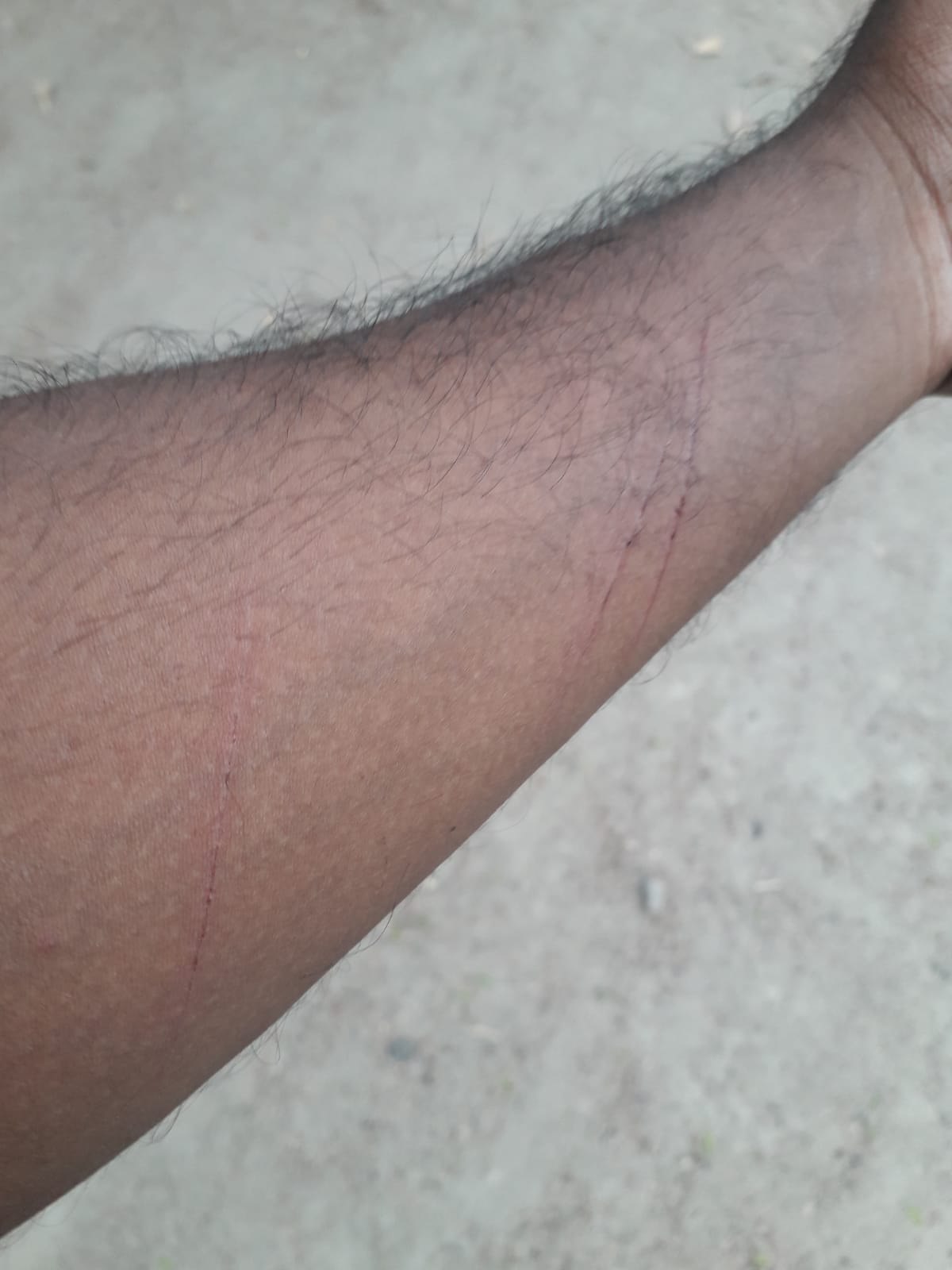 ভোরের কাগজের সাংবাদিককে হত্যাচেষ্টা