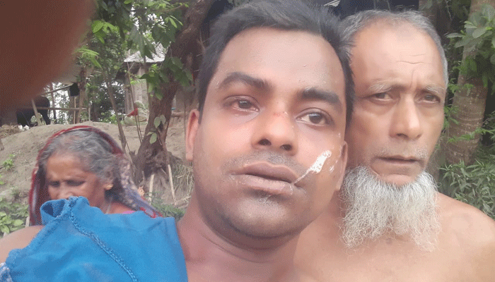 ভোরের কাগজের সাংবাদিককে হত্যাচেষ্টা