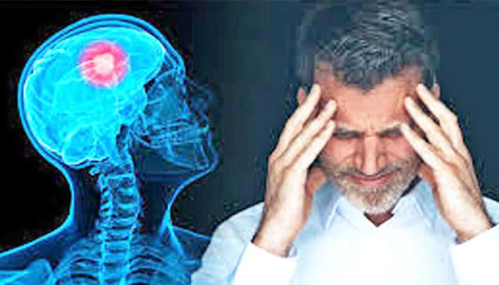 দেশে বছরে ২০ হাজার মানুষ ব্রেন টিউমারে আক্রান্ত