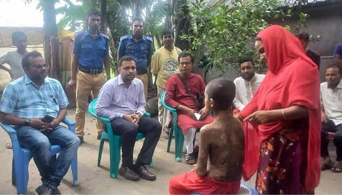 চর্মরোগে আক্রান্ত স্কুল ছাত্রী আশামনির পাশে দাঁড়ালেন ইউএনও
