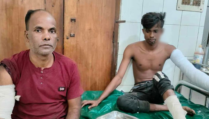 গাজীপুরে কাভার্ডভ্যানে পেট্রোল বোমা নিক্ষেপ, হেল্পারসহ দগ্ধ ২