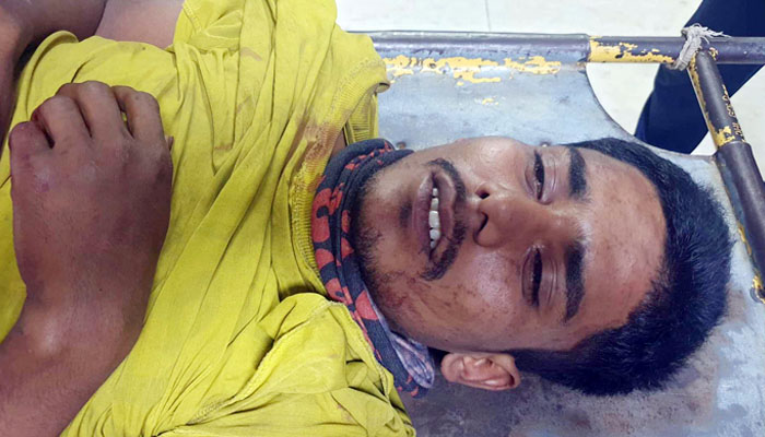 কানের দুল গিলে ফেলে হাসপাতালে ছিনতাইকারী