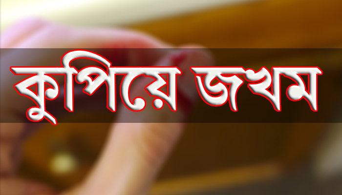 কুমিল্লায় ছাত্রলীগ নেতাকে কুপিয়ে জখম