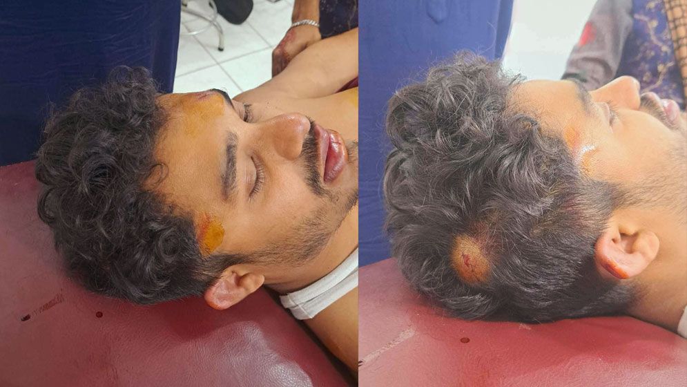 দুর্বৃত্তদের হামলায় গুরুতর আহত সময়ের আলোর নিজস্ব প্রতিবেদক
