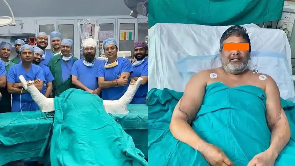 দিল্লিতে প্রথম হাত প্রতিস্থাপনে ‘নবজীবন’ শিল্পীর