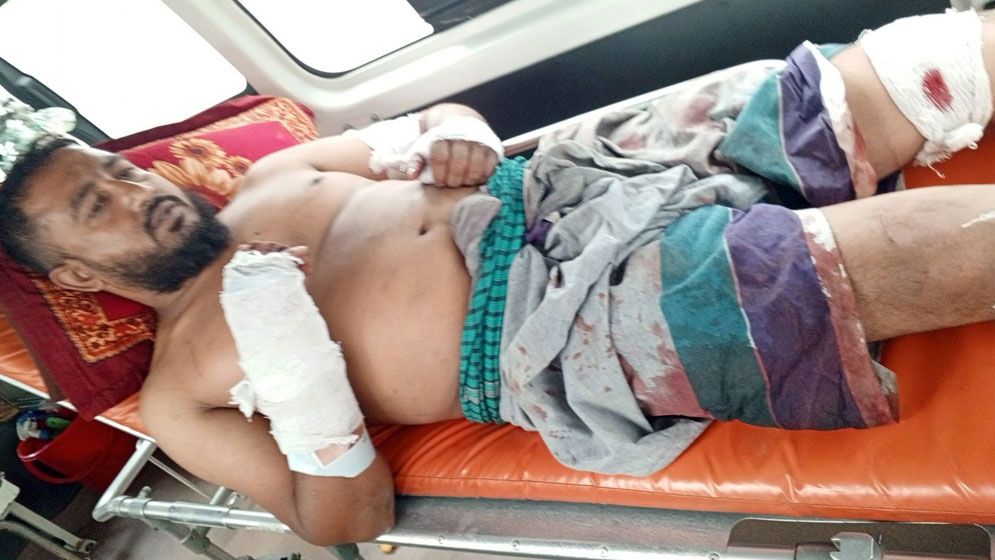 চাটমোহরে যুবলীগ নেতাকে কুপিয়ে জখম