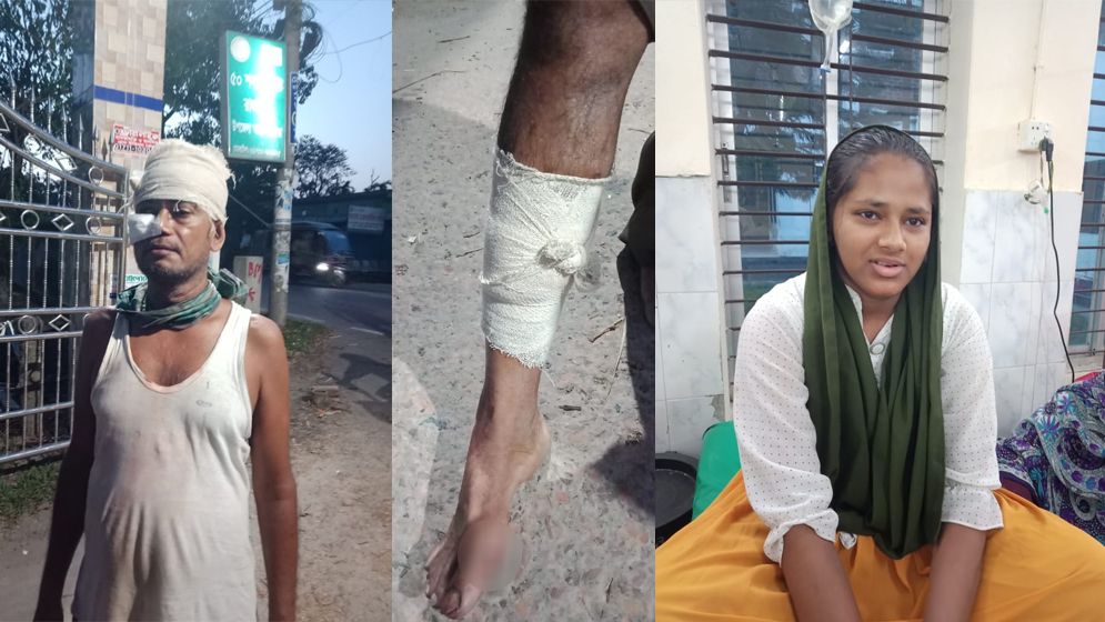 স্কুল ছাত্রীকে মারধর ও বাবাকে কুপিয়ে জখম