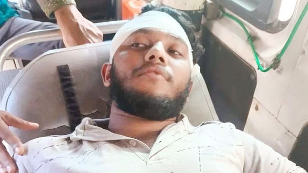 বৈষম্যবিরোধী ছাত্র আন্দোলনের এক শিক্ষার্থীকে পিটিয়ে জখম