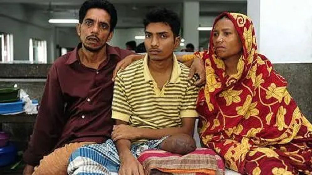 তারিক সিদ্দিকসহ ৯ জনের বিরুদ্ধে র্যাবের গুলিতে পা হারানো লিমনের অভিযোগ