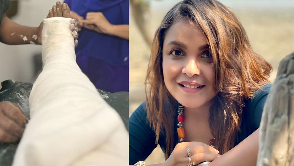 অটোর ধাক্কায় পা ভাঙল শাওনের, চালককে জানালেন ধন্যবাদ