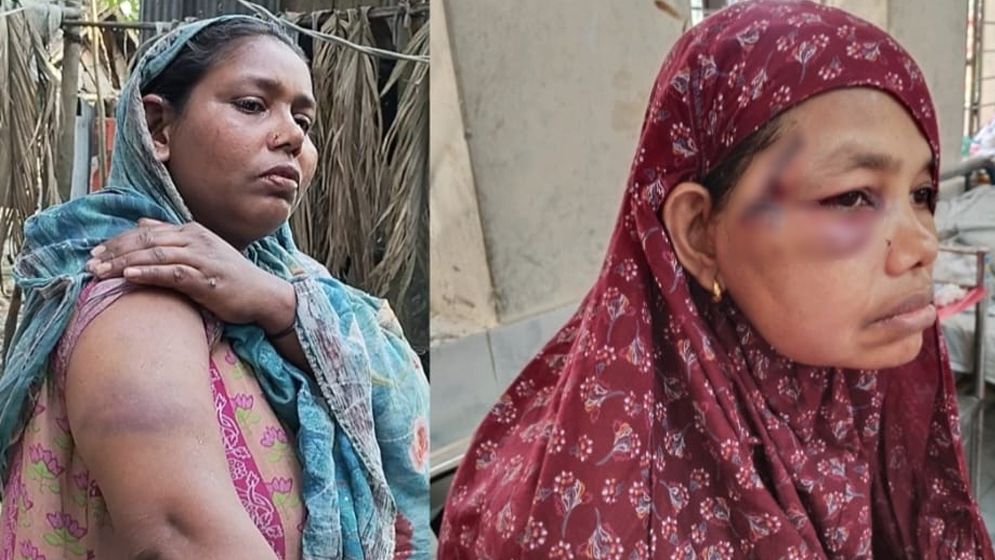 দাঁড়িপাল্লায় ভোট দেওয়ায় তিন নারীকে পিটিয়ে আহত