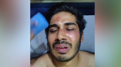 অতিরিক্ত ভাড়া নেওয়ার প্রতিবাদ, চবি শিক্ষার্থীকে পেটাল সিএনজিচালক