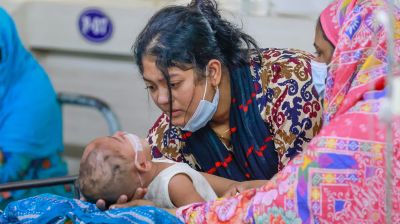 হাম ও হামের উপসর্গে শিশু মৃত্যু ৫০০ ছাড়াল 