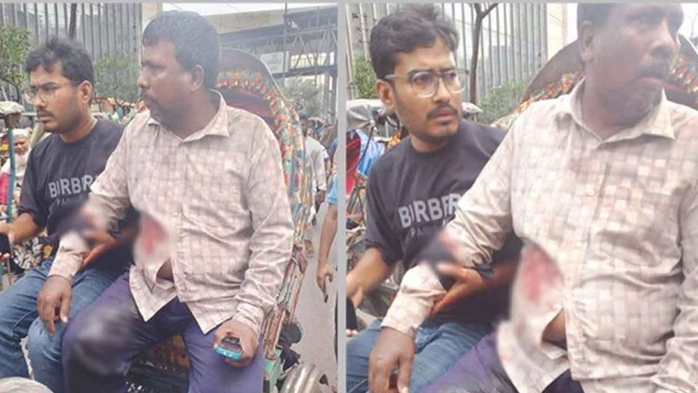 মতিঝিলে ব্যবসায়ীকে গুলি করে ১৭ হাজার ডলার ছিনতাই