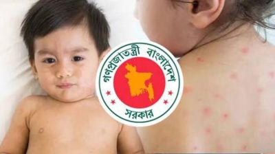 হাম উপসর্গে আরও ৫ জনের মৃত্যু