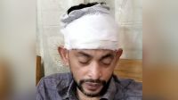 কর্মীকে ‘গুলি করে হত্যাচেষ্টা’ বিএনপি নেতার, ককটেল হামলা