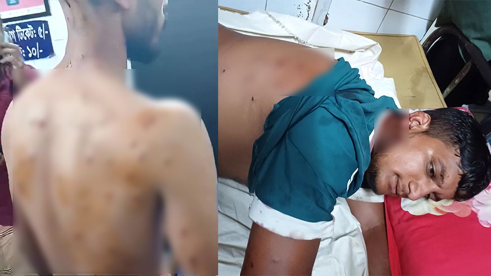 ‘জামায়াত-শিবির করিস বলে পিস্তল ঠেকিয়ে হুমকি’, গুলিবিদ্ধ ৫