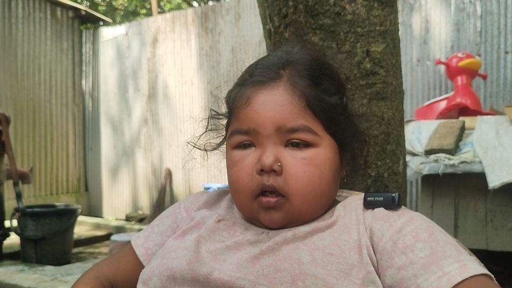 কিডনি রোগে ভুগছেন ১৫ বছর, অর্থাভাবে বন্ধ চিকিৎসা 