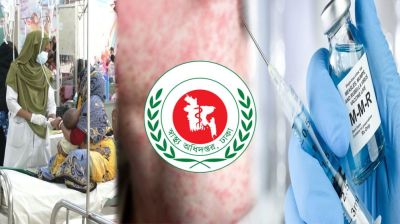 হামের উপসর্গে একদিনে ৯ জনের মৃত্যু