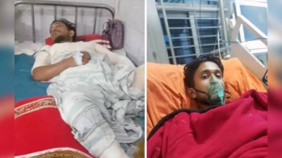 ১৬ দিন ধরে বার্ন ইউনিটে মৃত্যুর সঙ্গে পাঞ্জা লড়ছেন সাব্বির, সহায়তার আবেদন
