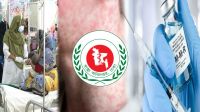 হামের উপসর্গে একদিনে ৯ জনের মৃত্যু